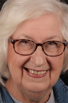 Before and after smile transformation by Advanced Dental Implant and TMJ Center in Southaven, MS.